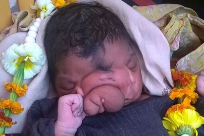 印度「象鼻」女嬰 村民當神崇拜 | 