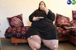 醫生勸不聽 女子胖到272公斤