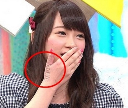 恐怖握手會! 女星被恐嚇:打爛妳鼻子… | 川榮李奈在握手會攻擊事件後留下10公分傷疤。 