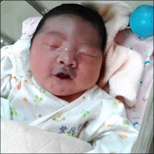 太壯啦! 4580公克巨嬰 生到臉瘀青 | 華視新聞