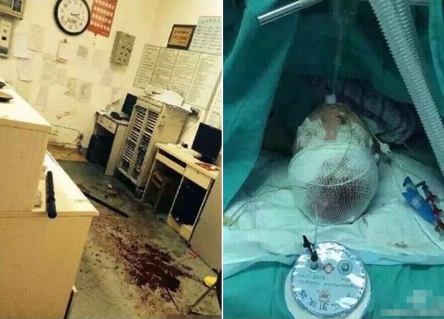 大陸驚傳隨機殺人? 女護士頭部遭砍傷… | 華視新聞