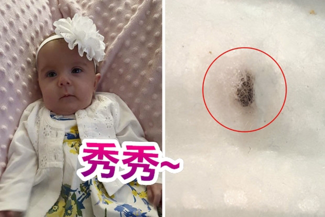 扯!知名尿布內藏凶器 割傷5月大女嬰 | 華視新聞