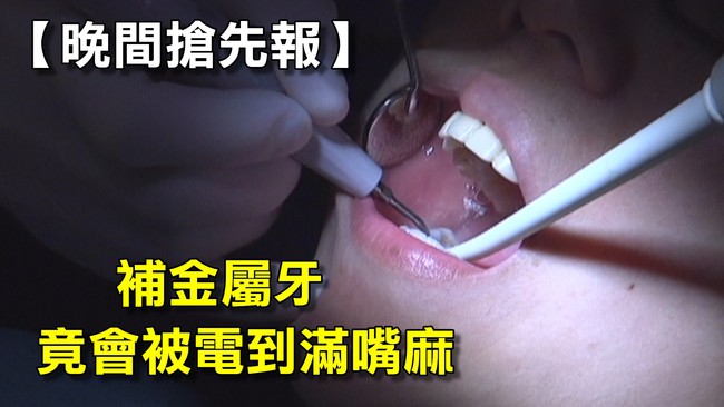 【晚間搶先報】補金屬牙 竟會電到滿嘴麻 | 華視新聞