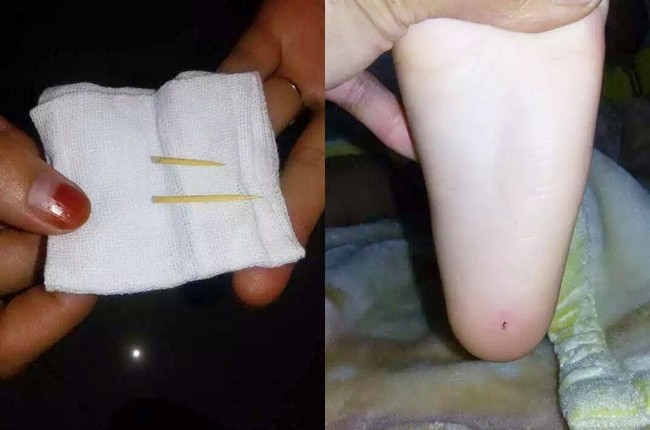 變態！腳底遭插牙籤 4歲童:老師弄的 | 華視新聞