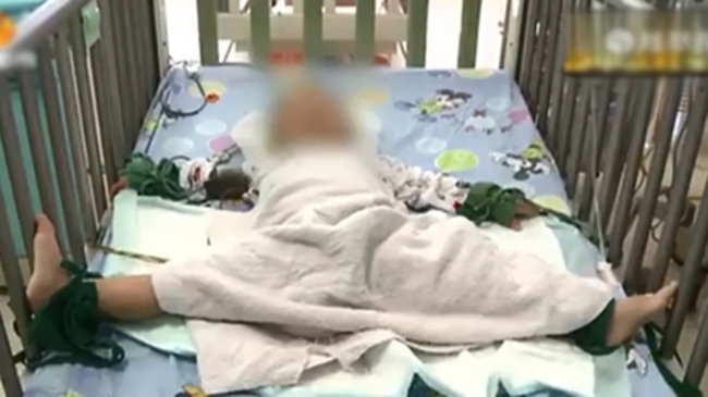 2歲男童吃棒棒糖 搖頭嗨翻陷昏迷 | 華視新聞