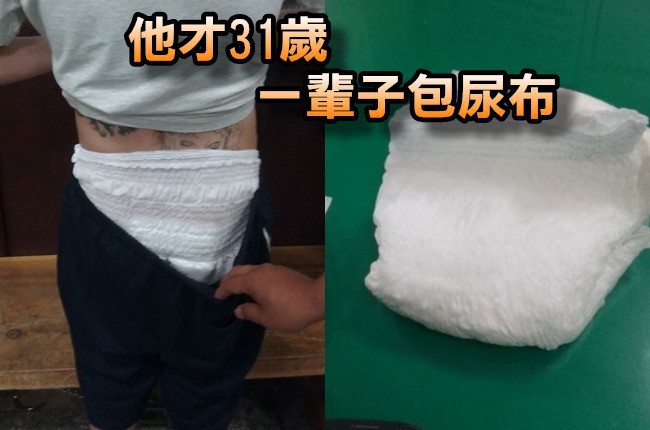他做了這件事...31歲尿失禁 終身包尿布! | 華視新聞