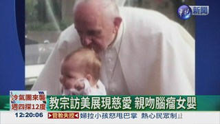 教宗親吻後 女嬰腦瘤奇蹟縮小