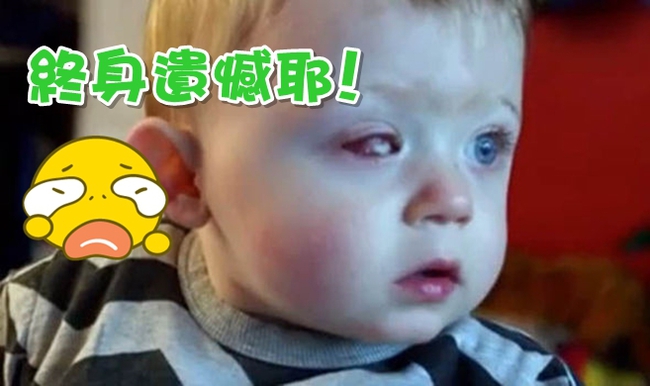 英國男童遭無人機撞傷 右眼被割除 | 華視新聞