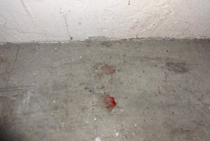 大屠殺?! 診所天花板竟滴血 兇手呼之欲出 | 當時清潔人員在地上發現血跡 從天花板滴落