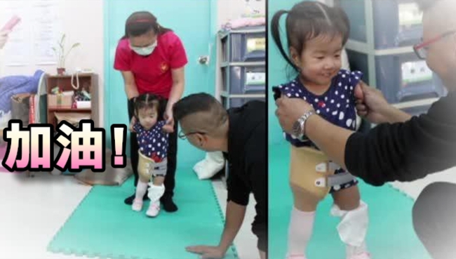 單腳2歲女童好棒! 人生的第一步 | 華視新聞