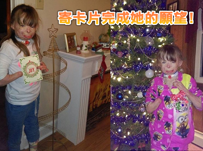 完成她的願望!火吻女童想收到聖誕卡片 | 華視新聞