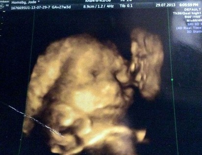 細看胎兒超音波照 你可能會毛毛的... | 已故祖父出現照片右方親吻孫兒(翻攝英國鏡報)