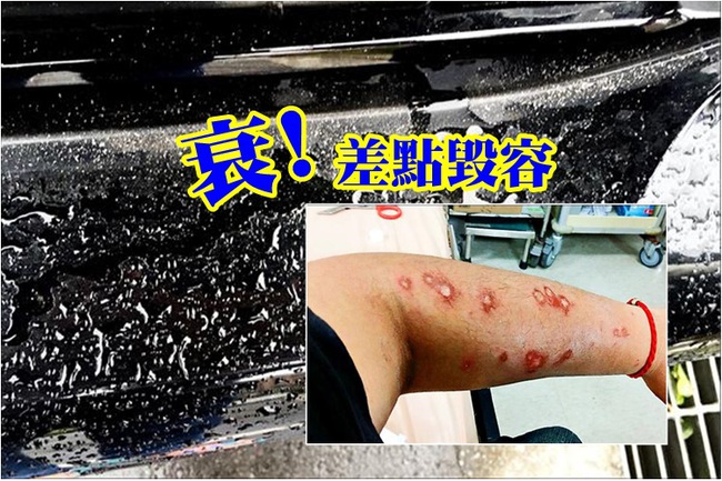 【午間搶先報】衰! 停車被撒白粉末 女手腳灼傷 | 華視新聞