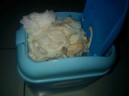 噁! 打手槍衛生紙堆一個月 竟出現這個... | 室友的衛生紙竟然長出了大量的香菇