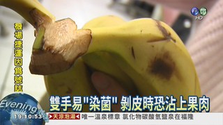 避病菌下肚 吃香蕉前先"洗皮"