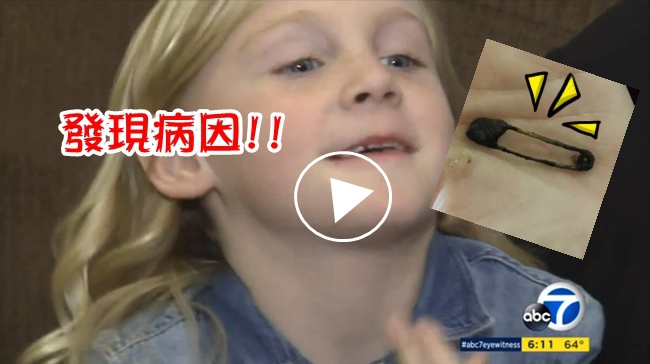 鼻涕流半年 女童ㄧ擤噴出4公分別針! | 華視新聞
