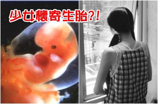 15歲少女神奇「胎中胎」 孿生手足寄生體內 | 華視新聞