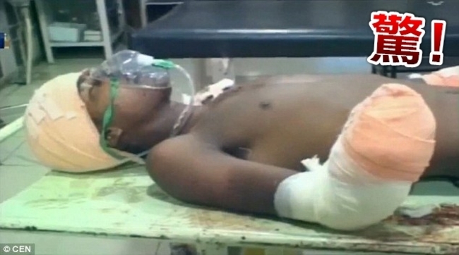性侵女嬰 印度17歲少年被女嬰父砍斷雙手 | 華視新聞