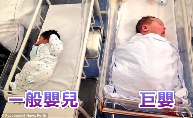 驚人! 澳洲媽生5.9公斤巨嬰 醫師:15年首見 | 華視新聞
