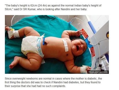 印度史上最高、最重巨嬰! 重達6.8公斤 | BBC報導印度婦人誕下巨嬰.