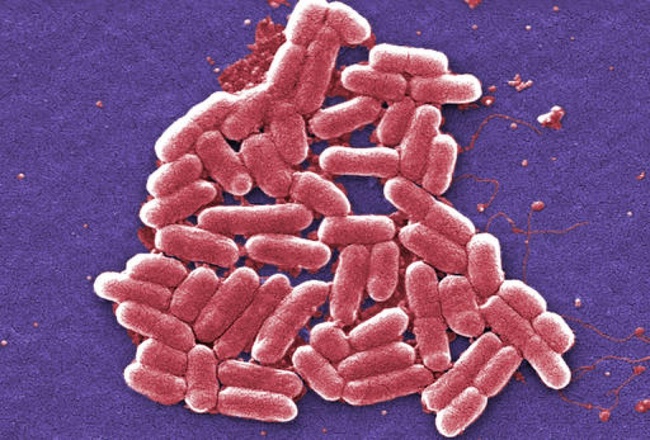 美驚見"超級細菌"! 全球無抗生素可治 | 華視新聞