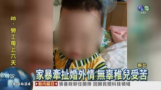 1歲童全身傷 疑遭母"小王"虐打