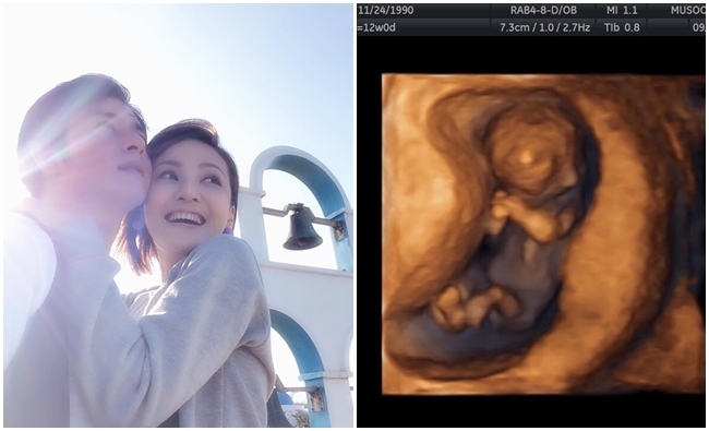 陳子玄懷孕 臉書:從未想過的意料之外 | 華視新聞