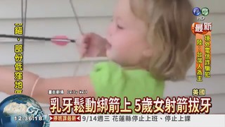 乳牙鬆動綁箭上 5歲女射箭拔牙