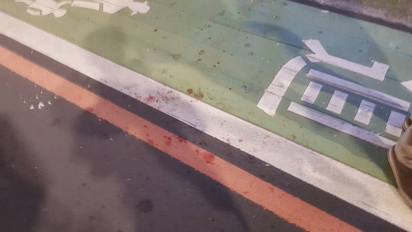 捷運永安站住戶高處丟玻璃 女子頭破血流 | 