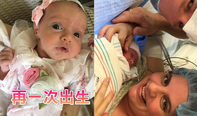 出生過兩次 美女嬰進出子宮開刀活命【圖】 | 華視新聞