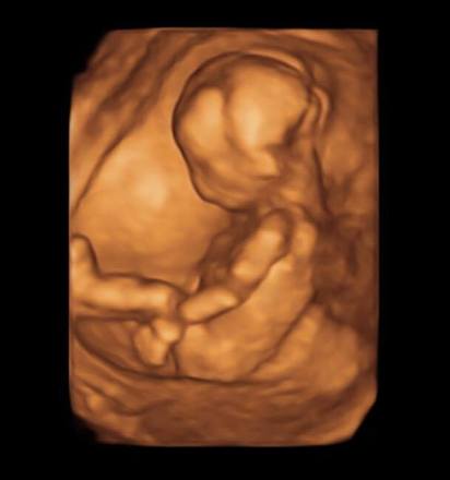 陳子玄秀5月孕肚! 自嘲像「剛吃飽」 | 陳子玄上個月產檢時，所公布的4D超音波照片。