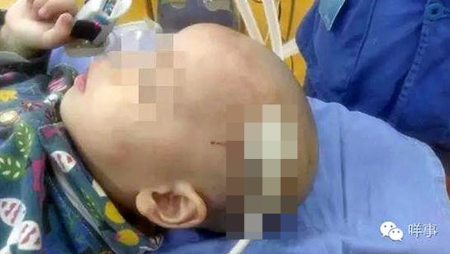 2歲小男童滾下床 頭竟插入插頭嚇壞娘 | 華視新聞