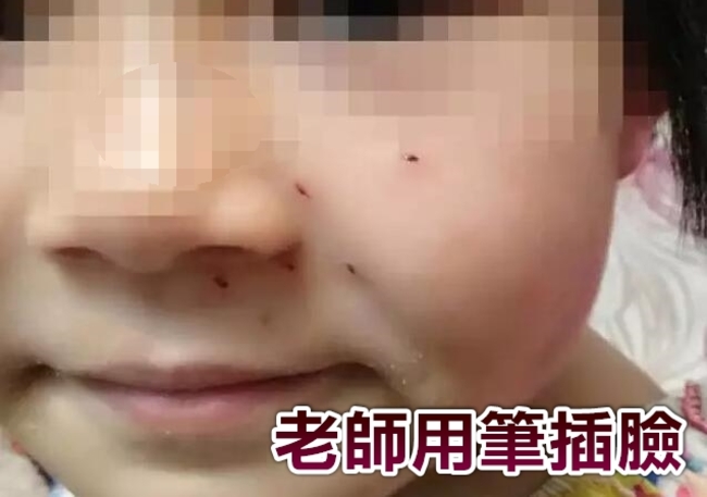 「10+9」算不出來 女童遭老師用筆插臉 | 華視新聞