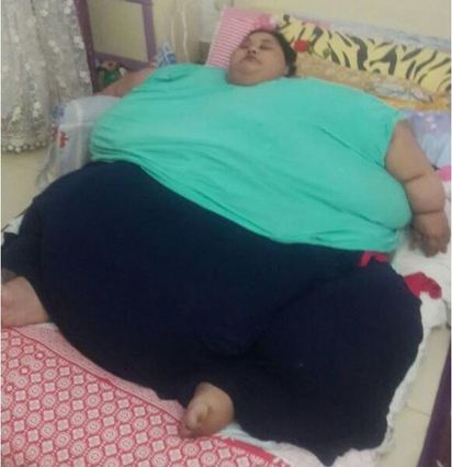 世界最重女子 如願往印度動減重手術 | 25年沒有出過門的艾提.