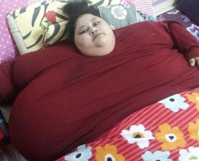 世界最重女子 如願往印度動減重手術 | 華視新聞