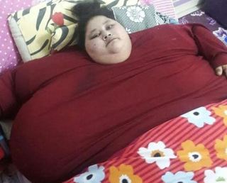 世界最重女子 如願往印度動減重手術
