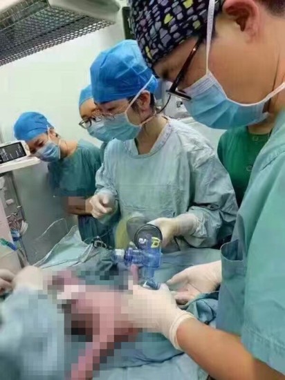 陸百公斤孕婦剖腹產 16名醫護接力接生 | 最終小孩平安出生