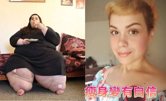 290公斤胖妹 減重後模樣超驚人 | 華視新聞