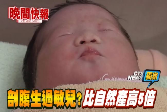 【晚間搶先報】嬰幼兒過敏 剖腹產風險更高? | 華視新聞