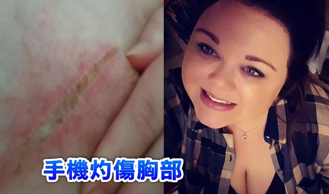 三星Galaxy S7再傳過熱 她的左乳房被灼傷 | 華視新聞