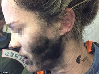 耳機突爆炸 女客機上臉頰燒到變黑