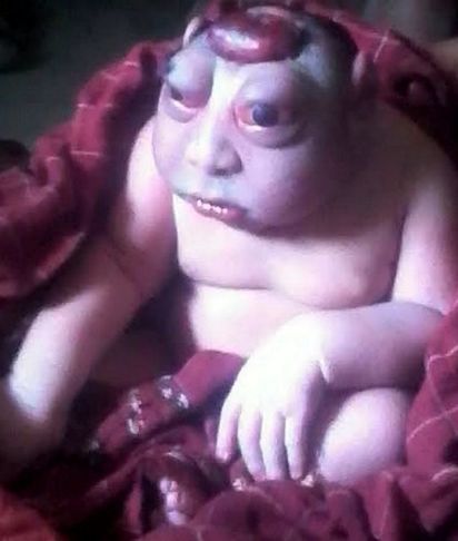 印度媽產畸型男嬰 村民認定猴神轉世 | 男嬰雙眼突出。