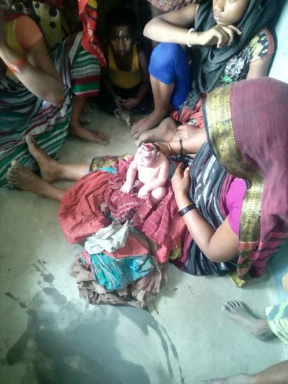 印度媽產畸型男嬰 村民認定猴神轉世 | 男嬰母親不敢哺乳。