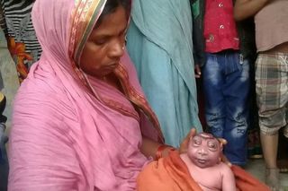 印度媽產畸型男嬰 村民認定猴神轉世