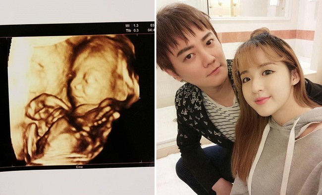 "公主出產地" 阿沁公布第二胎寶寶性別 | 華視新聞