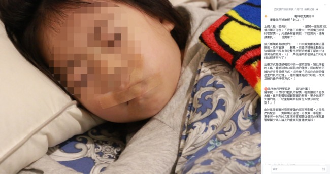 女兒矯正呼吸嘴巴貼膠帶 醫師打臉批作法錯了 | 華視新聞