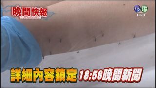【晚間搶先報】獨!五大類型注意 蚊子最愛"叮"你
