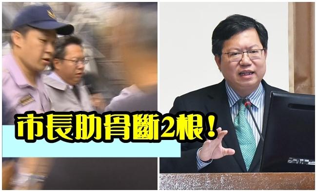 反年改群眾攻擊 桃市長鄭文燦肋骨斷2根不提告 | 華視新聞