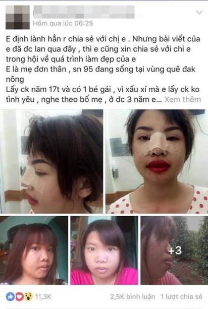 越南22歲女花43萬整型變正妹 閃嫁富二代 | 郭金鳳整型。