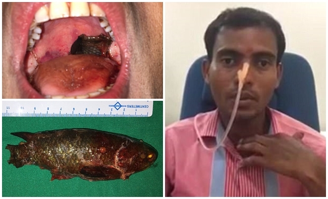 印度男"生吞"活魚 卡喉嚨急救險窒息! | 華視新聞